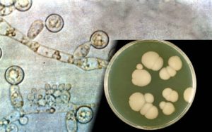 Candida-Albicans