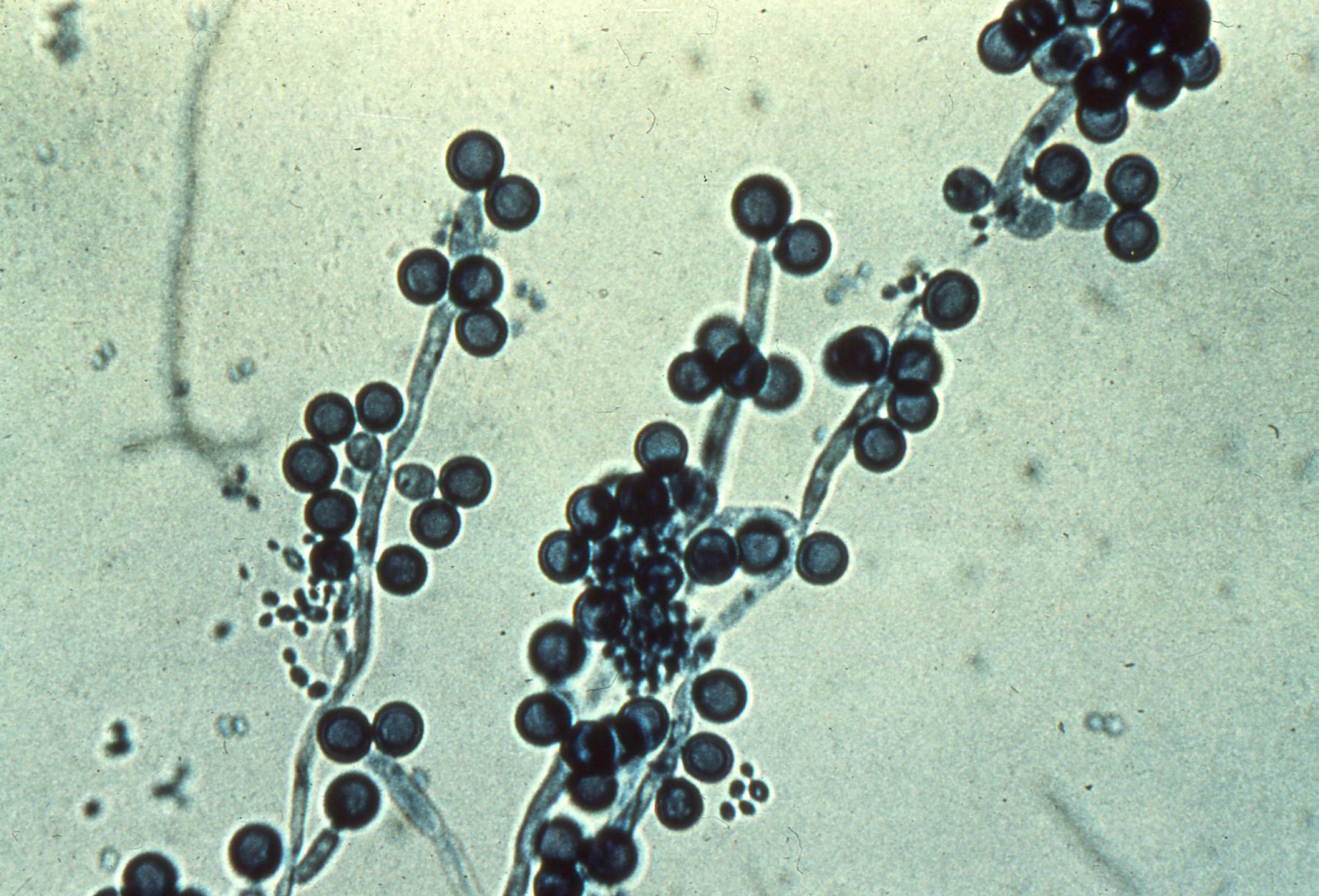 Дрожжеподобные грибы candida. Кандида альбиканс под микроскопом. Грибок рода кандида под микроскопом. Дрожжеподобные грибы рода кандида.