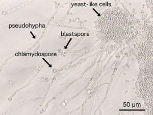 c-albicans