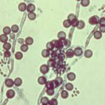 candida-albicans-in-men-women