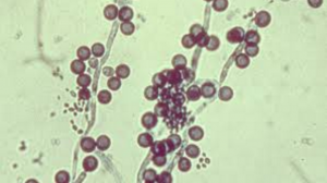 candida-albicans-in-men-women