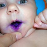 gentian-violet-baby-300×224