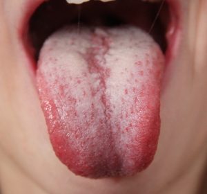 tongue-4